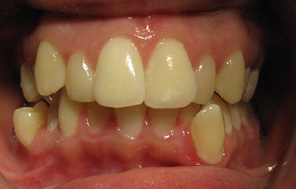 before dental treatment