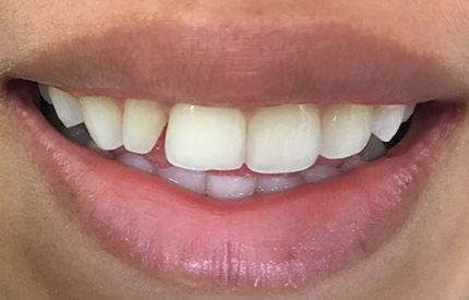 before dental treatment