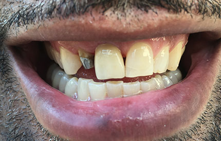 before dental treatment