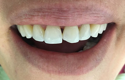 before dental treatment