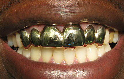 before dental treatment