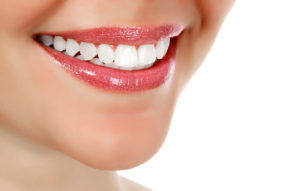 Close-up of a woman's smile showcasing bright, white teeth after dental bonding, emphasizing cosmetic dental care and results.