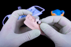 Dental Care Group prosthetics
