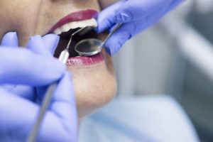 dental checkup