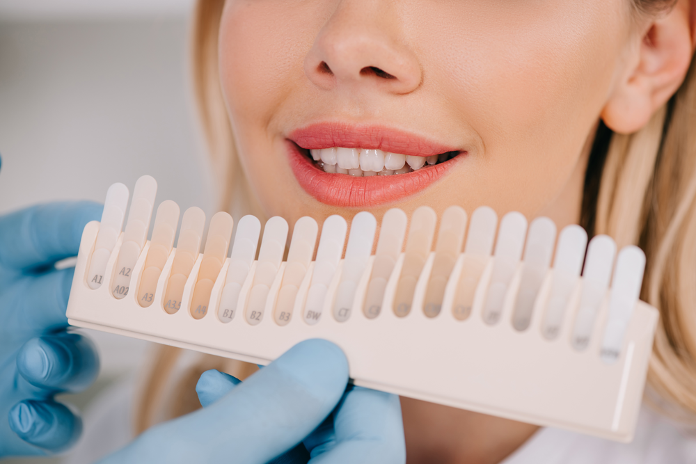 teeth whitening at Dental Care Group