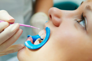 dental procedure