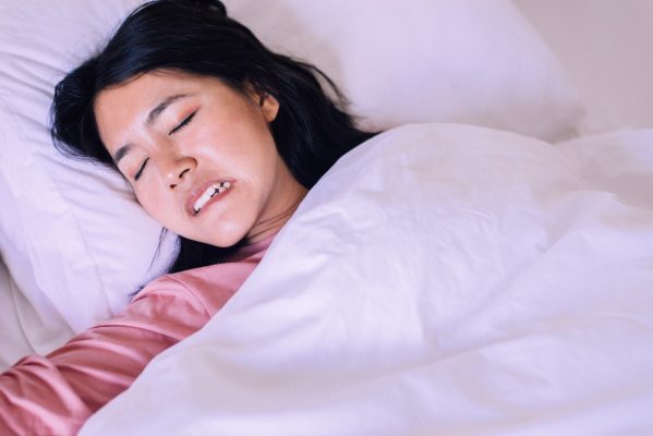 bruxism while sleeping
