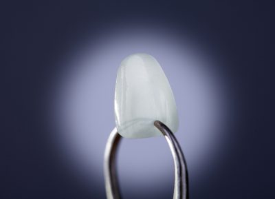 Tooth,Lumineer,In,Holder,On,Blue,Background,With,Vignette
