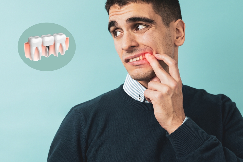 dental implant emergency