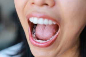 woman with mouth open